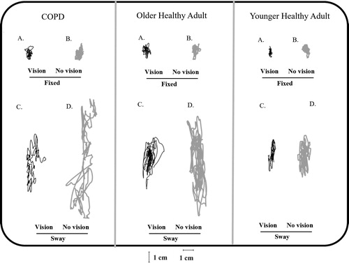 Figure 1. Statokinesiogram for representative individual of each group in the vision and surface condition (COPD, older healthy adults and younger healthy adults); (A) fixed surface/full vision, (B) fixed surface/no vision, (C) sway-referenced surface/full vision, and (D) sway-referenced surface/no vision. The black line represents the full vision and the gray line no vision condition.