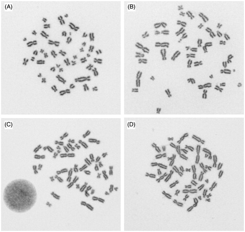 Figure 5. Four digital images from Gallery B evaluated by 17 laboratories, A: 17 x two dicentrics, B: 3 x rejected, 8 x no dicentric, 6 x one dicentric, C: 6 x no dicentric, 11 x one dicentric, D: 1 x rejected, 12 x one dicentric, 4 x two dicentrics