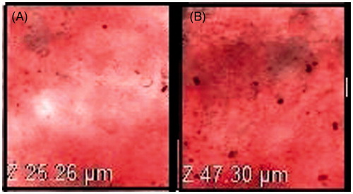 Figure 4. Confocal laser microscopy of Rhodamine loaded (A) liposome formulation (B) nanoethosome formulation (100×).