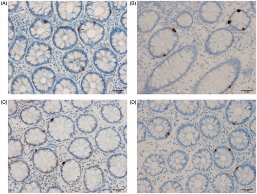 Figure 5. Serotonin cells in the rectum of a Thai control (A), in a Thai IBS patient (B), in a Norwegian control (C), and in a Norwegian IBS patient (D).