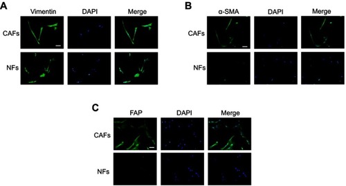Figure 1 Characterization of CAFs isolated from human HCC tissues. The expression of Vimentin (A), a-SMA (B) and FAP (C) in the purified fibroblasts was determined by immunofluorescent staining. CAFs highly expressed mesenchymal markers α-SMA, FAP and Vimentin. Bar scale, 200 µm.Abbreviations: HCC, hepatocellular carcinoma ; CAFs, cancer-associated fibroblasts; α-SMA, alpha-smooth muscle actin; FAP, fibroblast activation protein; NFs, normal fibroblasts.