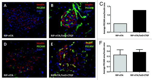 Figure 4. Effects of adult β cell CTGF overexpression on islet vascularity. Immunolabeling of control (A, D) and CTGF-overexpressing (B, E) pancreata after one (A, B) or five (D, E) weeks of CTGF induction (insulin: red; PECAM: green; DAPI: blue, nuclei) (Magnification 200). (A-C) Preliminary data suggests that one week of CTGF overexpression may increase islet vascular density in ~7-week-old mice. (D-F) Islet density is not increased after five weeks of CTGF overexpression. In C, n = 1 for each genotype. In F, n = 2 for each genotype.