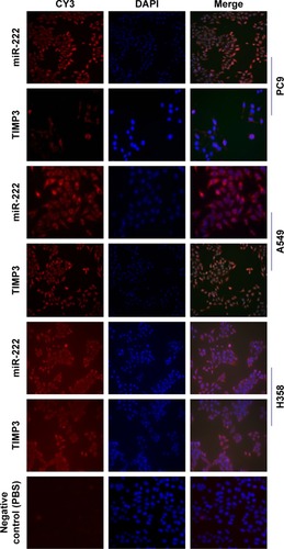 Figure 2 The distribution of TIMP3 and miR-222 in H358, A549, and PC9 cells was observed by IF.