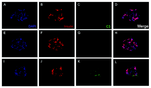Figure 1. Complement deposition on islets exposed to type 1 diabetic serum. Isolated islets were fixed and cryosectioned at 6 μm thickness and consecutive sections were used per condition. Islet sections were incubated in a 1:2 dilution of autologous serum (A–D), allogeneic serum (E–H) or type 1 diabetic serum (I–L) at 37°C for 2 h. Sections were washed and labeled with rabbit polyclonal anti-C3-FITC (green) or mouse monoclonal anti-insulin conjugated to AF647 (red). Only type 1 diabetic serum displayed signs of complement deposition (K), which corresponded to an islet cell as evidenced by positive insulin staining (J). DAPI was used for counterstaining (blue).