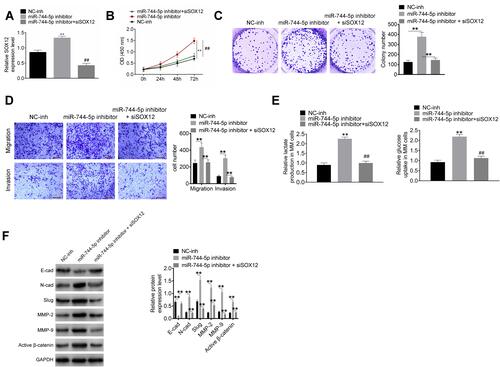 Figure 4 Down-regulation of miR-744-5p exacerbated malignant phenotype of MM cells in vitro by elevating SOX12. (A) SOX12 expression in U1996 cells was successfully regulated by transfection. **P<0.01 when compared with the NC-inh group. SOX12 expression was normalized to GAPDH. ##P<0.01 when compared with the miR-744-5p inhibitor group. (B) CCK-8 assay indicated that down-regulation of miR-744-5p enhanced U1996 cells proliferation by elevating SOX12. **P<0.01 when compared with the NC-inh group. ##P<0.01 when compared with the miR-744-5p inhibitor group. (C) Plate clone formation experiment revealed that down-regulation of miR-744-5p enhanced U1996 cells malignant proliferation by elevating SOX12. **P<0.01. (D) Transwell experiment illustrated that down-regulation of miR-744-5p intensified U1996 cells invasion and migration via elevating SOX12. **P<0.01. (E) Down-regulation of miR-744-5p increased glucose uptake and lactate production of U1996 cells through elevating SOX12. **P<0.01 when compared with the NC-inh group. ##P<0.01 when compared with the miR-744-5p inhibitor group. (F) Western blot exhibited that, relative to the miR-744-5p inhibitor group, much higher E-cadherin protein expression and lower N-cadherin, Slug, MMP-2, MMP-9, and active β-catenin proteins expression was observed in the miR-744-5p inhibitor + siSOX12 group. Down-regulation of miR-744-5p reduced E-cadherin protein expression and increased the expression of N-cadherin, Slug, MMP-2, MMP-9, and active β-catenin proteins in U1996 cells through elevating SOX12. Each protein expression was normalized to GAPDH. **P<0.01.