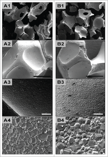 Figure 1. shows SEM pictures of the analyzed bone substitute granules. A1–3 show the properties of BoneCeramic (BC) with granule sizes between 500–1000 μm, while B1–3 show the characteristics of BoneCeramic (BC) with granule sizes between 400–700 μm. Note the differences in granule sizes between BoneCeramic 500–1000 µm and 400–700 µm (A1 and B1), while no differences were observable in the other physical properties, such as granule shape (A2 and B2), surface texture and pore distribution (A3 and B3) (A1 and B1: 25x magnification, scale bar = 1 mm; A2 and B2: 200x magnification, scale bar = 200 µm; A3 and B3: 1000x magnification, scale bar = 20 µm).