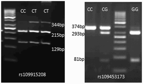 Figure 1. PCR-RFLP profile of SNPs on 3.5% agarose gel.
