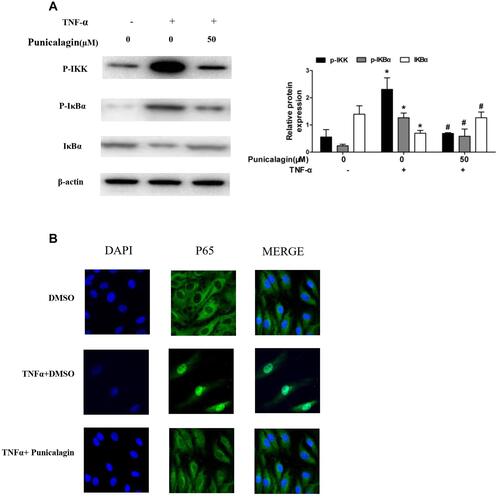 Figure 7 Punicalagin inhibits TNF-α induced NF-κB pathway activation and p65 relocation. (A) RA FLSs were pre-incubated with punicalagin for 24 h and TNF-α (10 ng/mL) for 15 min. Phosphorylation of IKK and IκBα induced by TNF-α was analyzed by Western blot analysis. The right panel shows a densitometric analysis of Western blots. The experiment was repeated at least three times. Each bar represents mean ± SD from 6 RA patients. *P < 0.05 vs control, #P < 0.05 vs TNF-α. (B) Immunofluorescence staining analysis of p65 localization. RA FLSs were pre-incubated with 50μM punicalagin for 24 h and TNF-α (10ng/mL) for 15 min, fixed, and then underwent immunofluorescence assay. The cells were stained with anti-p65 (in green) and DAPI (in blue). Representative 200× images.