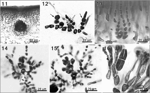 Figs 11–16. Phyllymenia reproductive morphology. Fig. 11. A maturing cystocarp surrounded by involucral filaments, deeply embedded in the inner cortical layers. Fig. 12. Squashed carpogonial ampulla, with an 8-celled primary filament from which secondary filaments have developed from the first and fifth cell (black arrows), the hypogenous cell (hy) bears a 4-celled filament (white arrow). Fig. 13. A narrowly flask-shaped auxiliary cell ampulla with three, simple secondary filaments. Figs 14, 15. Successive stages of gonimoblast development, and formation of involucral filaments; note connecting filaments (cf) attached to the auxiliary cell (ac). Fig. 16. Detail of cruciately divided tetrasporangium and tetrasporangial initials (arrowhead) within modified outer cortical cells.