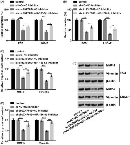 Figure 7. Silencing circular RNA circZNF609 (circZNF609) restrained cell migration and invasion through up-regulating microRNA (miR)-186-5p. (A) miR-186-5p inhibitor conspicuously enhanced circZNF609-induced decline in PC3 and LNCaP cell migration. (B) miR-186-5p inhibitor conspicuously enhanced the circZNF609-induced decline in PC3 and LNCaP invasion. (C–E) Silencing circZNF609 meaningfully declined levels of matrix metalloproteinase-9 (MMP-9) and Vimentin, and miR-186-5p inhibitor conspicuously reversed this expression. (*p < .05; **p < .01; ***p < .001).