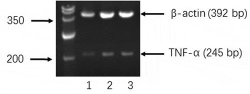 Figure 4. Effects of BPFs on the expression of TNF-α in RAW264.7 cells. RAW264.7 cells were cultured with medium alone (lane 1), BPFs (10 μg/ml) (lane 2), and LPS (10 μg/ml) (lane 3) separately for 18 h.