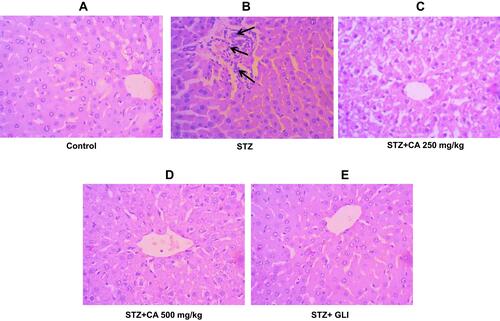 Figure 8 Histological evaluation of liver after treatment with CA. (A) Hepatocytes of control animals. (B) Inflammatory cells infiltration after STZ-induced diabetes. Hepatocytes of animals treated with CA leave extracts (C, D) and glibenclamide (E).