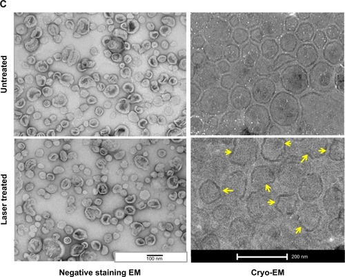 Figure 3 Effect of laser treatment on the biophysical characteristics and integrity of liposomes.Notes: (A) Formulation IV (calcein-HPPH) or V (calcein only) were treated with 660 nm laser for 5 minutes and were analyzed for changes in their UV-VIS spectral properties and hydrodynamic size analysis by DLS. Data for Formulation IV is shown in (A) (a) and (c). Data for Formulation V is shown in (A) (b) and (d). UV-VIS spectra are shown in left panels (A [a] and [b]) where absorbance is plotted against the wavelength (nm). Hydrodynamic size analysis is shown in right panels (A [c] and [d]). Average diameter (x-axis) is plotted against the peak intensity of liposomes (average of three runs from a single experiment). Dashed lines, control samples; solid lines, 5 minute laser-treated samples. The results are representative of at least three independent experiments. (B) Effect of laser treatment on fractionation pattern of liposomes on a size exclusion column: Formulation IV (calcein-HPPH liposomes) was either untreated or treated with the laser for 5 minutes and was fractionated on a Sepharose CL-6B column. 1 mL fractions were collected. 0.2 mL aliquots of the column fractions were analyzed for the HPPH by monitoring absorbance at 665 nm. The absorbance of HPPH in each fraction is plotted against the fraction numbers in (B). Dashed lines, untreated liposomes; solid lines, laser-treated liposomes. (C) Effect of laser treatment on morphology of liposomes: Formulation IV (calcein-HPPH liposomes) was treated with the laser for 5 minutes and the liposomes were imaged by electron. The images are shown in (C). Left panel, negative stained liposomes; top, untreated; bottom, laser treated, (bar 100 nm). Right panel, cryo-EM images liposomes; top, untreated; bottom, laser treated, (bar 200 nm). Arrows indicate deformability (crenations) in the liposomes upon laser treatment.Abbreviations: DLS, dynamic light scattering; EM, electron microscopy; HPPH, 2-[1-hexyloxyethyl]-2-devinyl pyropheophorbide-a; UV-VIS, ultraviolet–visible spectroscopy; min, minute.