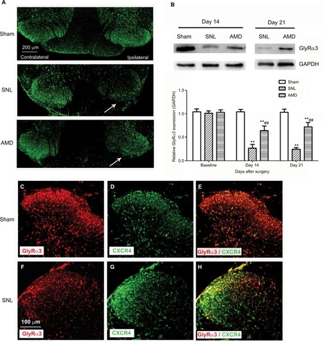 Figure 5 Effects of AMD3100 on GlyRα3 expression in spinal DH.