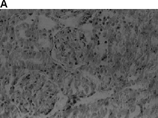 Figure 4 Hematoxylin and eosin stained sections of rat kidneys: A) renal cortex of rat treated with vehicle (olive oil); B) interstitial fibrosis of stripped pattern and tubular atrophy in cortex of CsA-treated rats; C) arteriole with marked luminal narrowing and pronounced intimal thickening in CsA rats; D) renal cortex of rats treated with nifedipine (5 mg/kg) showing interstitial fibrosis as well as arteriolopathy similar to CsA; E) renal cortex of rats treated with nifedipine (10 mg/kg) showing some arteriolopathy, interstitial fibrosis; and F) renal cortex of rats treated with nifedipine (20 mg/kg) that prevented the development of CsA-induced alterations.