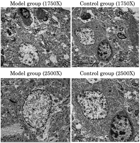 Figure 2. The details of the hippocampal tissue in the model and sham-operated groups.