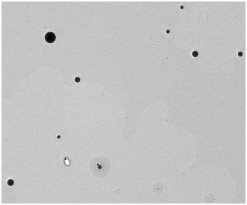 Figure 1. Transmission electron microscopy (TEM) of nanoparticles.