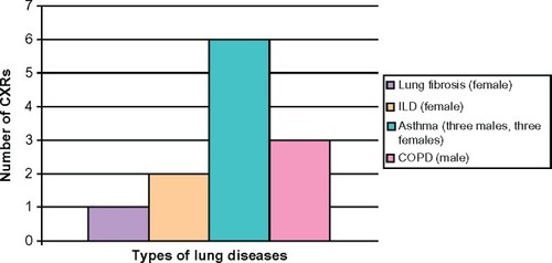 Figure 2 Distribution of lung etiologies in patients.Abbreviations: CXRs, chest X-rays; ILD, interstitial lung disease; COPD, chronic obstructive pulmonary disease.