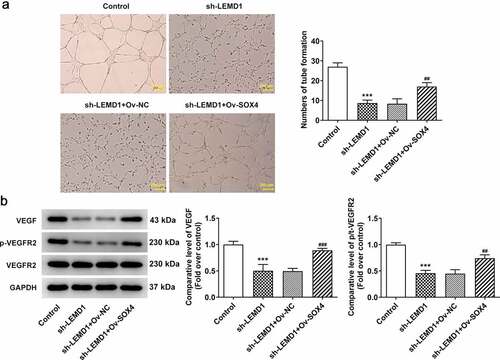 Figure 6. LEMD1 mediated by SOX4 induces angiogenesis in colon cancer cells. (a) Tube formation assay detected angiogenesis. Magnification, x4. (b) The protein levels of VEGF and p-VEGFR2/VEGFR2 were determined by western blot. ***P < 0.001 vs. control; ##P < 0.01, ###P < 0.001 vs. sh-LEMD1+ Ov-NC.