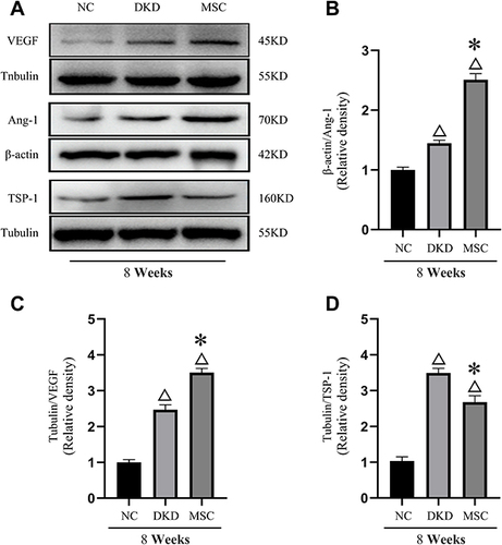 Figure 7 hAMSCs transplantation improved protein expressions of VEGF, Ang-1, and TSP-1 in T1DRM at 8 weeks (as determined by WB analysis) (A–D). Note: Compared with the NC group, ΔP < 0.05; Compared to group DKD, *P < 0.01.