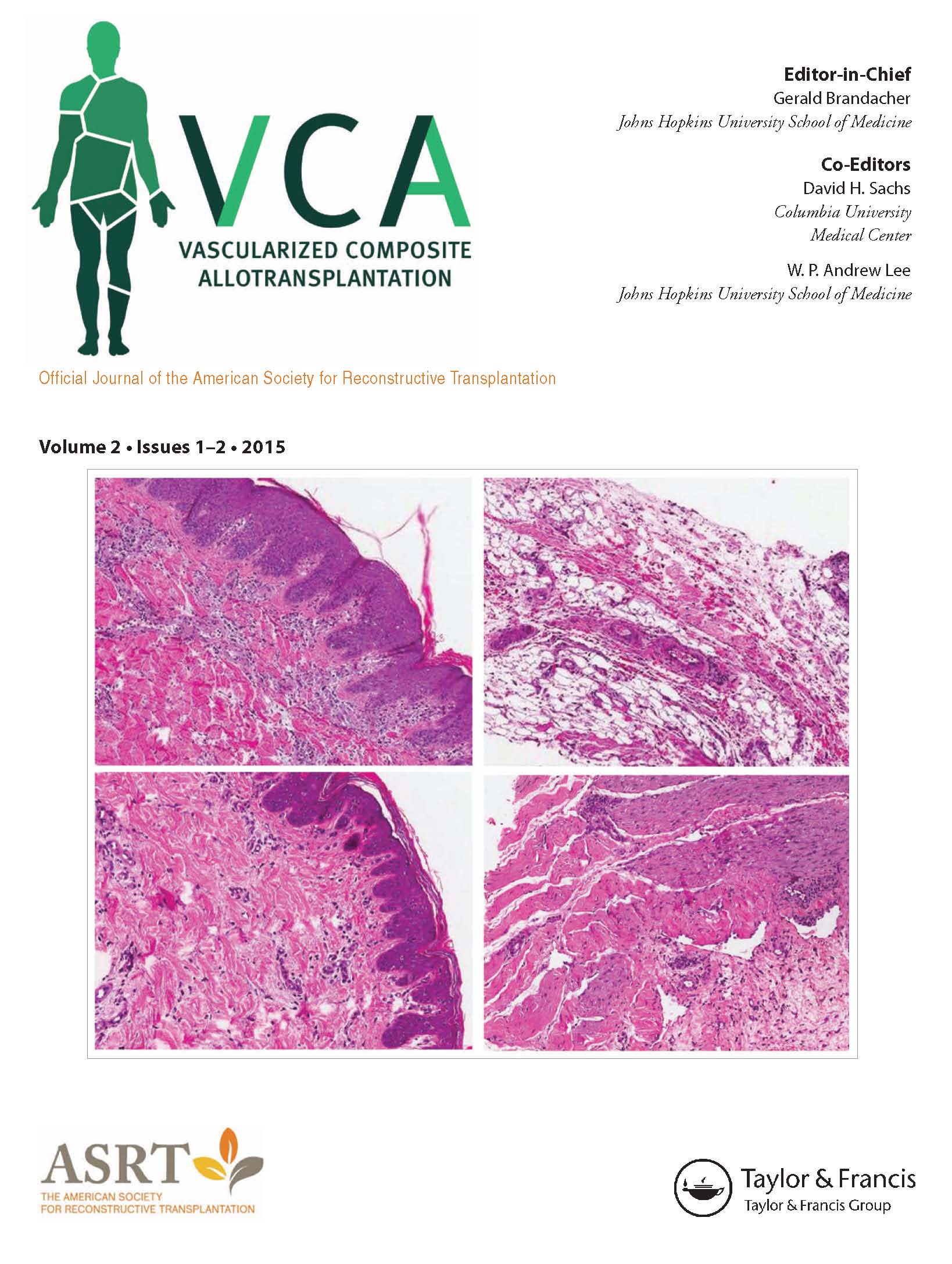 Cover image for Vascularized Composite Allotransplantation, Volume 1, Issue 1-2, 2014