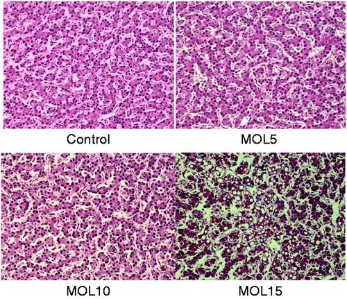 Figure 1. Liver histopathology of layers fed diets supplemented with different levels of Moringa oleifera leaf (MOL) (haematoxylin and eosin staining, magnification, 200×).