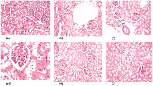 Figure 4. (a) Photomicrograph of kidney tissue section of control rats showing no histopathological alteration and the normal histological structure of the glomeruli and tubules at the cortex are observed (H&Ex40). (b) Photomicrograph of kidney tissue section of diabetic rats showing degenerative changes and nephrosis in the tubular lining epithelium (H&Ex40). (c, c1) Photomicrograph of kidney tissue section of diabetic nephroapathy rats showing degenerative changes and nephrosis in the tubular lining epithelium associated with perivascular inflammatory cells aggregation surrounding the congested blood vessels (H&Ex40) and c1 (H&Ex80). (d) Photomicrograph of kidney tissue section of diabetic rats treated with MSCs showing congestion in the tufts of the glomeruli (H&Ex40). (e) Photomicrograph of kidney tissue section of diabetic nephroapathy rats treated with MSCs showing congestion in the glomeruli and blood vessels (H&Ex40).