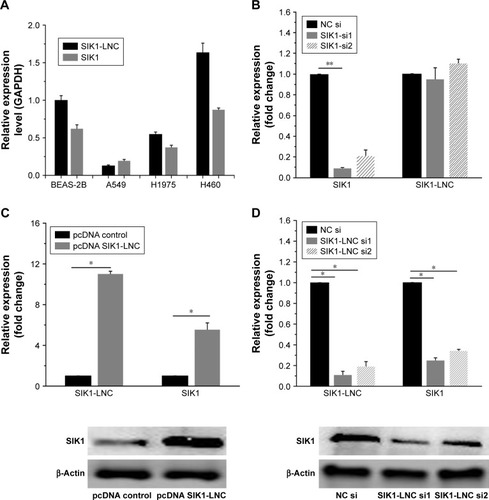 Figure 2 SIK1 expression was co-regulated together with the SIK1-LNC overexpression or knockdown in king cancer cell lines. (A) CCK-8 assay indicated A549 cell viability in pcDNA SIK1-LNC groups was lower than that in the pcDNA control group (P<0.05). (B) The Brdu assays showed that cell proliferation properties were apparently impaired in the pcDNA SIK1-LNC group when compared with the pcDNA control group (P<0.05). (C) The wound healing and (D) cell invasion assays indicated that the pcDNA SIK1-LNC group showed significant inhibition on cell migration and invasion, in contrast with the pcDNA control group (P<0.05).