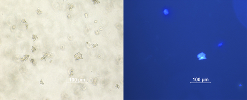 Figure 5. Fluorescence microscopy images of multicellular spheroids HCT116 cells incubated with coumarin-polymer micelles for 4 h. Left image is bright field and right is the fluorescence image.