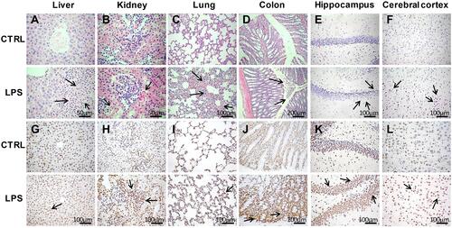 Figure 3 Histopathological analyses of tissues in the LPS and control groups. (A–F) Hematoxylin and eosin (H&E) staining of liver (400×), kidney (400×), lung (200×), colon (100×), hippocampus (200×), and cerebral cortex (200×) tissues in the LPS and control groups. (G–L) Terminal deoxynucleotidyl transferase dUTP nick end labeling (TUNEL) assays of liver, kidney, lung, colon, hippocampus, and cerebral cortex tissues (200×) in the LPS and control groups. The arrows point to the damage area.