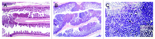 Figure 2. (A) Hematoxylin and eosin (H&E) stained small intestine from a Cables1+/+ApcMin/+ mouse with rare adenomas. (B) H&E stained small intestine from a Cables1−/− ApcMin/+ mouse with frequent adenomas. (C) An adenocarcinoma in the small intestine of a Cables1−/− ApcMin/+ mouse. Inset: higher magnification.