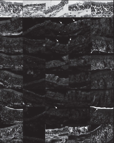 Figure 2. At 1 day after methimazole treatment (1d), there is a thin and disorganized neuroepithelium in the whole olfactory epithelium (OE; O). ORNs have almost completely disappeared. At 7 days later, OE shows signs of recovery but is still thin and disorganized (7d). At 1 month after treatment (1m), the OE is thicker, and after 3 months (3m) has regained its normal appearance and thickness. In general, the immunoreactivity of ORNs to TRPV1 is markedly reduced 7 days after methimazole treatment. A few cells show immunofluorescence (arrow). Immunofluorescence of ORNs has almost recovered (arrow) after 1 month and shows complete recovery after 3 months (TRPV1). Immunoreactivity of ORNs to TRPV2 is reduced in most ORNs, while a few cells show marked fluorescence (arrow) 7 days after the treatment. After 1 month, some cells show intense fluorescence (arrow), while others still show weaker fluorescence (TRPV2). Immunoreactivity of ORNs to TRPV3, TRPV4, and TRPA1 is reduced 7 days and 1 month after treatment. Immunoreactivity to TRPM5 is reduced after 7 days and 1 month. There is no fluorescence in olfactory cilia (arrow), while after 3 months, ORNs show normal fluorescence and there is intense staining in the olfactory cilia (arrow) (TRPM5). The immunoreactivity to TRPM8 is slightly weaker, but still strong after 7 days and 1 month, recovering to normal after 3 months (TRPM8).