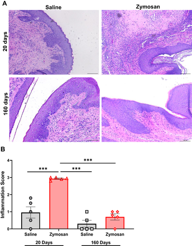 Figure 4 Morphological and inflammatory effects of zymosan challenges in the vulva. (A) Visual inspection of hematoxylin and eosin (H&E)–stained sections, 20 and 160 days of zymosan/saline administration in the vulva. Saline administration in the vulva does not have morphological or inflammatory effects. However, evidence of an active inflammatory process, marked dermal lymphocytic infiltrate with exocytosis, increase in the number and the activation of mast cells (See Figure 3) after 20 days of the 3rd round of zymosan administration in the vulva. However, after 160 days of the 3rd round of zymosan administration, there was no evidence of inflammation. (B) Inflammation score of the saline and the zymosan groups after 20 and 160 of 3rd round of zymosan/saline administration (n=5 per group). Mean ± SEM. ***P<0.001.