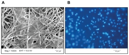 Figure 4 SEM micrograph (A) and DAPI staining image (B) of LSC attachment onto the surface of plasma-treated PCL nanofibers after 3 days.Abbreviations: DAPI, 4′,6-diamidino-2-phenylindole; LSC, limbal stem cell; PCL, poly (ɛ-caprolactone).