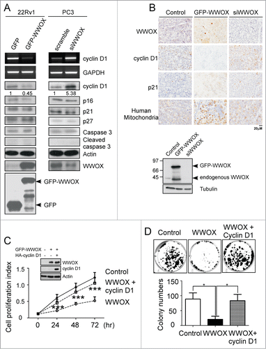 Figure 4. (See previous page). WWOX-mediated G1 arrest is through cyclin D1. (A) The ectopic expressed WWOX in 22Rv1 cell decrease cyclin D1 but not apoptotic-associated protein expression. In contrast, WWOX-silenced PC3 cell increase cyclin D1 expression. The protein expressions were measured by the antibodies shown at right. Cyclin D1 mRNA expression was measured under the same condition using RT-PCR. (B) Manipulated-22Rv1 derived tumor were collected to examine protein expression by immunohistochemistry. The protein expressions were measured by the antibodies shown at left. Representative WWOX expression level in injected-22Rv1 are validated by Western blot. Overexpress WWOX in 22Rv1 cell inhibit cell proliferation compare to control. While co-transfection of WWOX and cyclin D1 plasmids suppress WWOX-mediated cell growth. (C) After transfection, cell were collected and counted at 0, 24, 48 and 72 hours. Cell proliferation index represent proliferated cell number compare to 0 hour. Representative WWOX and cyclin D1 expression level are validated by Western blot. (D) Colony-forming assay of 22RV1 cell (control, WWOX and WWOX+cyclin D1). Quantification of colony numbers are shown on bottom panel. Data are representative of 3 independent performed experiments; mean ± SD; **, p < 0.005; ***, p < 0.001.