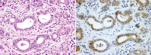 Figure 2. Histopathological and immunohistochemical findings of URAT1 in the human submandibular gland. (A) Hematoxylin-eosin staining of a serial section. (B) Immunohistochemical findings of URAT1 shows expression in the cytoplasm of striated ductal cells, with strong punctuate staining in part of the supra-nuclear cytoplasm. Compared with the staining results of OAT1-4, fewer cells are positive and staining intensity is weak.