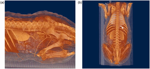 Figure 3. 3D vascular structures based on CT images. Based on the data, we selected perforators to be used in our experiment. (a) Lateral view; (b) dorsal view.