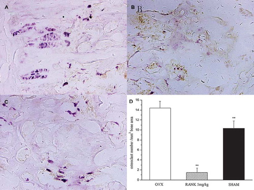 Figure 9. TRAP staining of decalcified sections of the distal femur showed that osteoclasts of the RANK group (B) were almost inhibited, while in the OVX group (A) and the sham group (C) there were many TRAP staining-positive osteoclasts. (D): Osteoclast counting in distal femur by TRAP staining; under a ×100 endoscope TRAP staining-positive cells of the distal femur sections were counted and we found that the lowest was the RANK group, and there were significant differences with the rest of the groups (F = 264.588, P< 0.01).