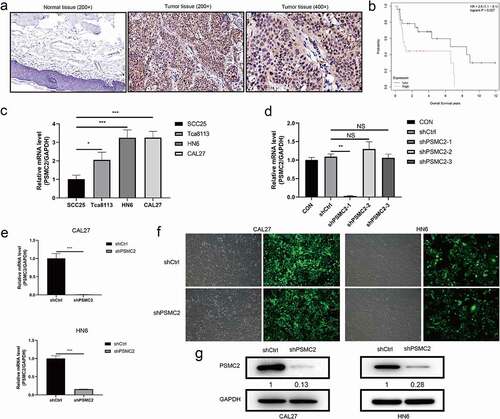 Figure 1. The upregulation of PSMC2 in OSCC and the construction of PSMC2 knockdown cell model. (a) Expression level of PSMC2 in normal tissues (200×) was detected by IHC staining. (b) The correlation between PSMC2 expression and survival of OSCC patients was analyzed based on data collected from GSE41116 dataset. (c) PSMC2 expressions in SCC25, Tca8113, HN6, and CAL27 were detected by qRT-PCR. (d) The knockdown efficiency of PSMC2 in shPSMC2-1, shPSMC2-2, and shPSMC2-3 group was detected by qRT-PCR. (e) The specificity and validity of PSMC2 expression knockdown by the lentivirus-mediated shPSMC2 was evaluated by qRT-PCR. (f) The infection efficiency for CAL27 and HN6 cells was evaluated by the expression of the green fluorescent protein. (g) The specificity and validity of PSMC2 expression knockdown by the lentivirus-mediated shPSMC2 was evaluated by Western blotting analysis. Data were shown as mean with SD (n ≥ 3). *p < 0.05, **p < 0.01, ***p < 0.001.