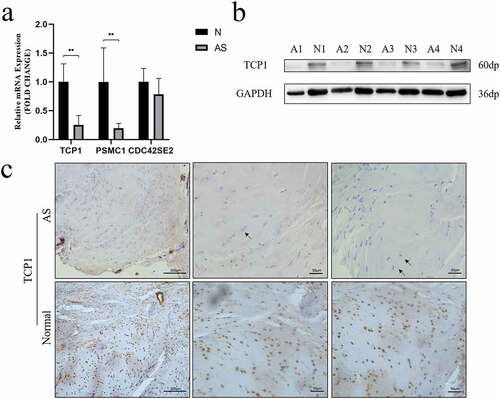 Figure 5. A TCP1 and PSMC1 mRNA expression were significantly decreased in AS patients. **P < 0.001. b TCP1 protein expression was analyzed using western blot. TCP1 protein levels in AS decreased compared to those in control. c Sections of interspinous ligament from AS patients and healthy controls were immunostained for TCP1 and counterstained with hematoxylin. The black arrows indicate fibrochondrocytes. Immunohistochemistry showed that TCP1 was expressed in the nucleus of fibrochondrocytes under normal conditions, but absent in AS patients