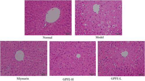 Figure 2 Histopathological observation of liver tissues sections in mice of the different groups after staining with hematoxylin and eosin (H&E).