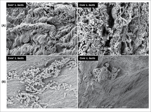 Figure 5. Cnm mediates binding to the collagenous fibrils of damaged and apparently undamaged infected human valve sections. SEM analysis of valve sections incubated with bacterial monocultures showed Cnm+ L. lactis binding to bundles of collagenous fibrils on the rough edges of the valves whereas no Cnm− L. lactis were found attached to this area (A). Cnm+ L. lactis could also adhere to tissue areas where no apparent damage was observed in contrast with their Cnm− counterparts (B).