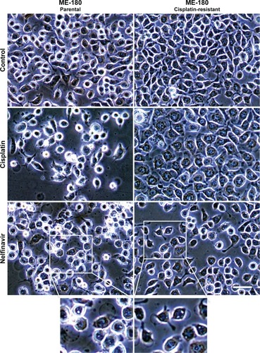 Figure 1 Morphology of ME-180 cells with or without nelfinavir treatment.