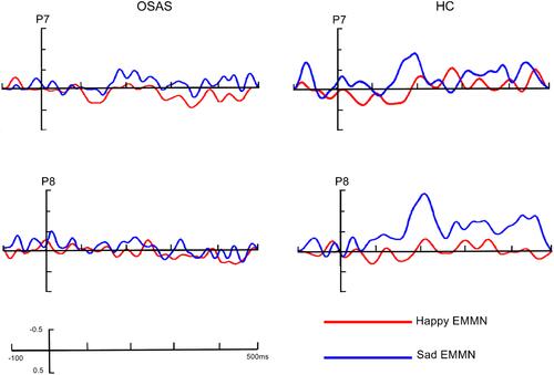 Figure 4 The grand-averaged EMMN waveforms in patients with OSAS and healthy controls at P7/P8 site.