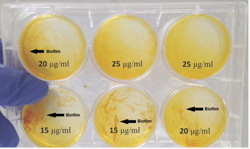 Figure 1 Nano-Curcumin inhibits the Biofilm in a concentration-dependent manner. The biofilm formation was reduced to 2+, 1+ and negative in 15, 20 and 25 µg/mL concentrations of Nano-Curcumin.