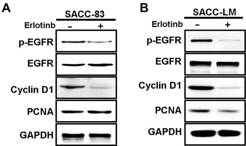 Figure 2 Western blot analysis against p-EGFR, EGFR, cyclin D1, and PCNA expression in SACC cells treated with erlotinib. (A) The protein expression of p-EGFR, EGFR, cyclin D1 and PCNA in SACC-83 cells treated with erlotinib (2uM, 3days) was analyzed by Western blot analysis. (B) The protein expression of p-EGFR, EGFR, cyclin D1 and PCNA in SACC-LM cells treated with erlotinib (2uM, 3days) was analyzed by Western blot analysis.