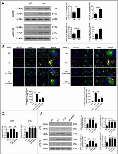 Figure 7. Downregulation of HMGB1 expression rescued HG-induced LMP via a CTSB- but not a CTSL-dependent pathway. (a) After exposure to NG or HG for 24 h, the total protein of HsRPE and ARPE-19 cells was subjected to western blot analysis using the indicated antibodies (CTSB, CTSL, and ACTB). ACTB was used as a protein loading control. Representative images from three independent experiments with biological and technical replicates are shown, n = 6. (b) HsRPE and ARPE-19 cells were pretreated with complete medium containing CA-074Me (10 ng/mL) or Z-FF-FMK (40 μM) for 1 h and then exposed to HG for 24 h. Immunofluorescence signals after double-staining for LGALS3 (red) and LAMP1 (green) in cell samples are shown, and Manders’ coefficients for colocalization of LGALS3 with LAMP1 were calculated. Representative images from three independent experiments with biological and technical replicates are shown. Scale bars: 10 μm, n = 6. (c) ARPE-19 cells were transfected with siRNA-HMGB1 and Scr-siRNA and then exposed to HG for 24 h. The mRNA expression of CTSB and CTSL in ARPE-19 cells was measured by real-time PCR, n = 6. (d) HsRPE and ARPE-19 cells were transfected with siRNA-HMGB1 and Scr-siRNA and then exposed to HG for 24 h. Cell samples were subjected to western blot analysis using the indicated antibodies (CTSB, CTSL, and ACTB). ACTB was used as a protein loading control. Representative images from three independent experiments with biological and technical replicates are shown, n = 6. #P > 0.05; **P < 0.01; ***P < 0.001.