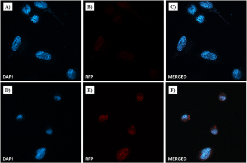 Figure 19 Dox nuclear localization in MDA-MB-231 cells by confocal microscopy. Cells were incubated with free-Dox (at 7.5 μM) (A–C) and NF-Dox (at 50 µM, ie, 7.5 µM of Dox) (D–F) for 1 h. Nuclei are stained in blue with DAPI. The intrinsically fluorescence of Dox is shown in red (RFP channel). Merged images derived from the overlapping of the two fluorescent emissions. Fluorescent microphotographs (63× oil immersion objective lens) are representative of three separate experiments.
