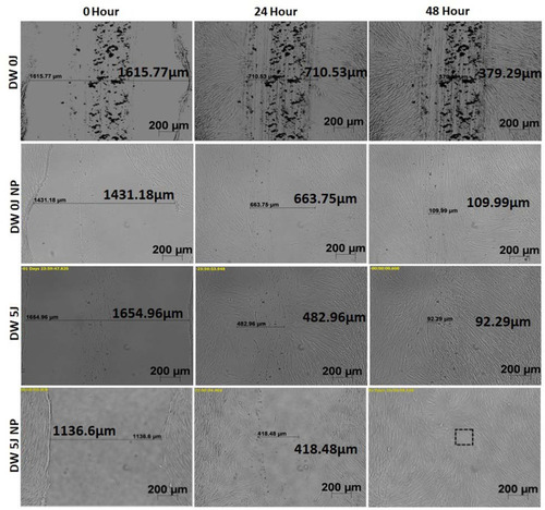Figure 3 Time-lapse micrographs of non-irradiated diabetic wounded cells (DW 0J); non-irradiated, G-AgNP treated diabetic wounded cells (DW 0J NP); irradiated, diabetic wounded cells (DW 5J); and irradiated, G-AgNP treated diabetic wounded cells (DW 5J NP), analysed at 0, 24 and 48 h.