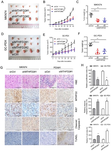 Figure 4. MTHFD2 knockdown suppresses GC tumorigenesis in vivo. (A–C) A xenograft model was established in nude mice subcutaneously implanted with MTHFD2-knockdown and control MKN74 cells (N = 5). Tumor images are presented (A). Tumor volumes were calculated (B) Tumor weights were obtained (C). (D–F) Patient-derived xenograft (PDX) tumors were implanted into the flanks of mice. Mice were treated with either PBS or si-MTHFD2. Tumor images are shown (D). Tumor volumes were calculated (E). Tumor weights were obtained (F). (G) Paraffin-embedded tumor sections derived from the indicated group were stained with hematoxylin and eosin (HE) or MTHFD2, Ki67 and cleaved caspase 3 antibodies or TUNEL assay. Ki67 levels are lower, whereas cleaved caspase 3 and TUNEL levels are higher, in tumor tissues with MTHFD2 knockdown. Representative staining images are shown (scale bar = 100 μm). H. The proliferation index (Ki67 staining), apoptotic index (cleaved caspase 3) and TUNEL index in tumor sections were quantified. Data are presented as mean ± SD, one-way ANOVA (parametric comparisons, C and F), Student’s t test (non-parametric comparison, H) or two-way ANOVA (B and E). ns, not significant, **P < 0.01.